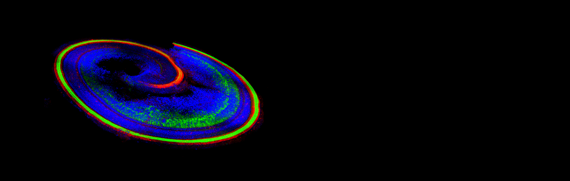 טיפול פורץ דרך לחירשות גנטית