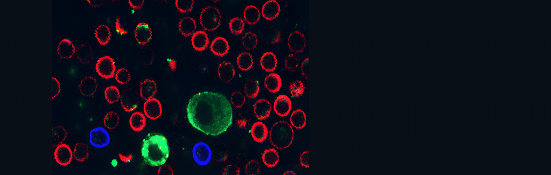 גילוי פורץ דרך חושף כיצד סרטן תוקף את מערכת החיסון