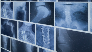 קורס אורתופדיה סימולציות שלב ב