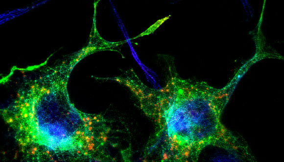 Modeling WWOX-Related Neurological Disorders: From Gene to Therapy Modeling WWOX-Related Neurological Disorders: From Gene to Therapy