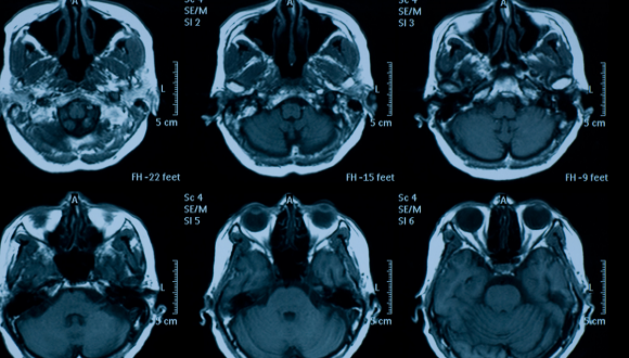 דימות | רדיולוגיה אבחנתית קורס דימות ורדיולוגיה אבחנתית