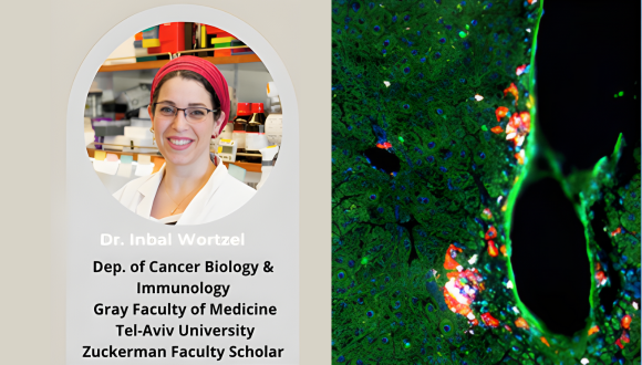 EV-DNA-Mediated Immune Communication: A Barrier to Metastasis