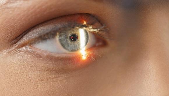 החוג לרפואת עיניים אופתלמולוגיה