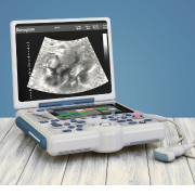 POCUS: כיצד מכשיר אולטרסאונד קטן משנה את פני רפואת המשפחה